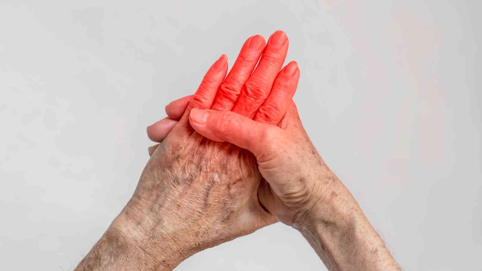 Two hands are clasped together; one hand appears normal while the other is shown in red, indicating inflammation or pain.