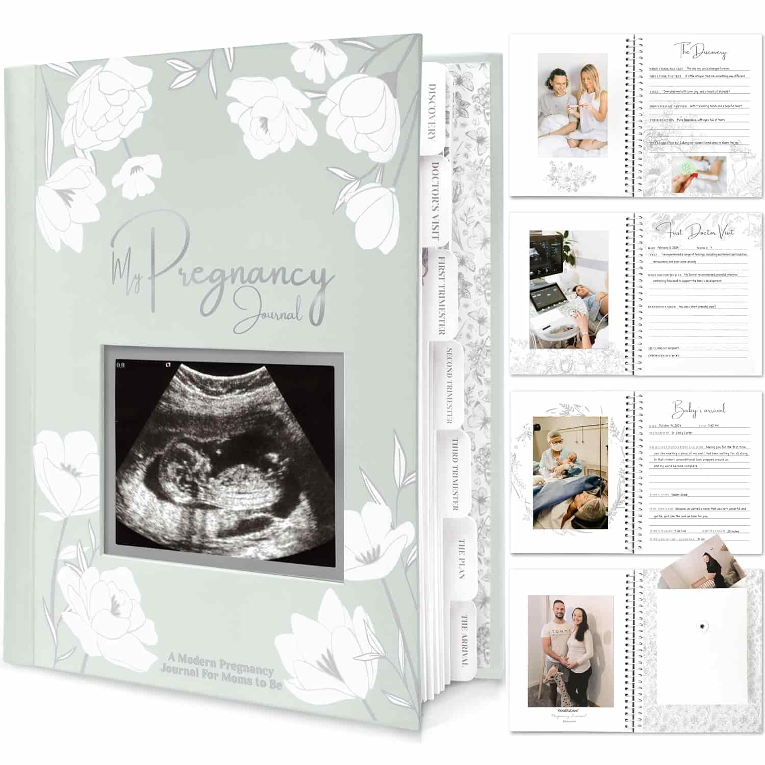 A pregnancy journal with a floral cover and an ultrasound photo, shown open to pages featuring prompts, photos, and sections for documenting pregnancy milestones.