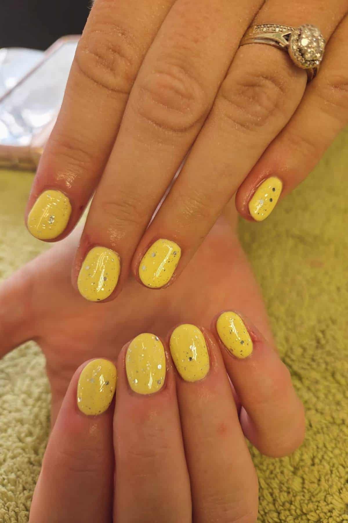Hands with short, rounded nails painted yellow with black speckles and a glossy finish. A ring with three stones is worn on the ring finger of one hand.