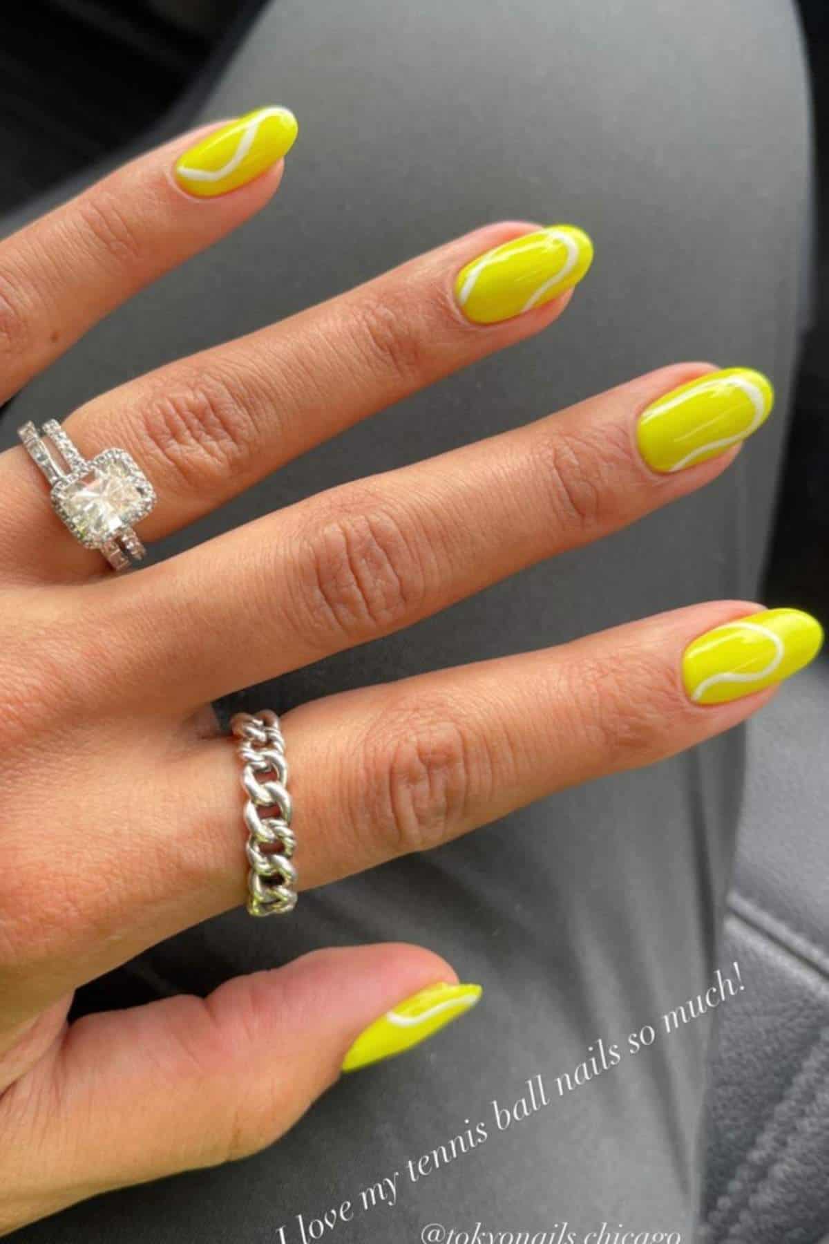 A hand with almond-shaped nails painted bright yellow with white swirls, wearing two rings, rests on a gray surface.
